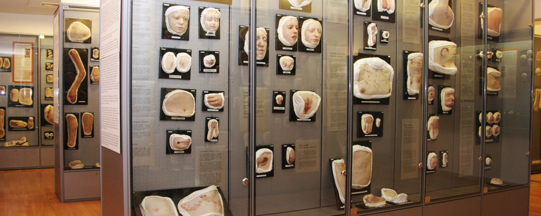 Die Ausstellung im Moulagenmuseum der Universität und des Universitätsspitals Zürich