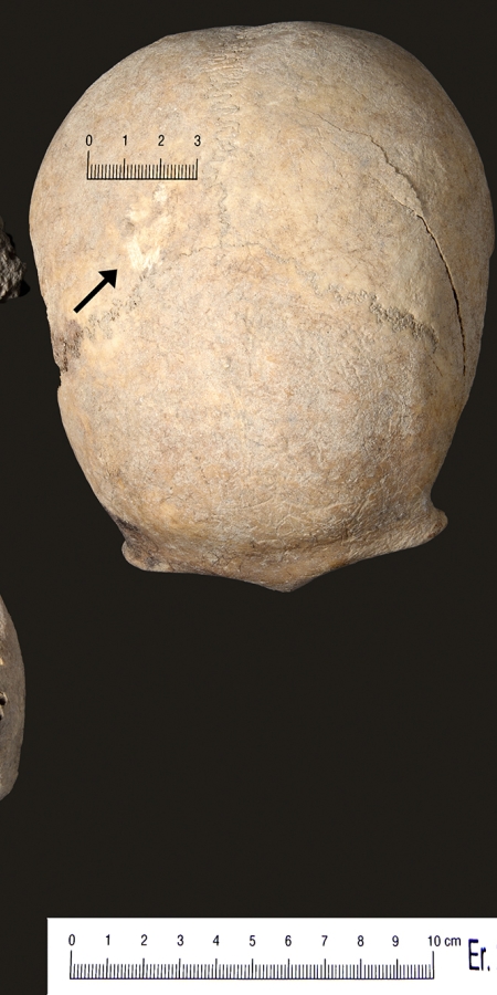 Knochen der Toten von Falein © Archäologischer Dienst Graubünden Knochen der Toten von Falein © Archäologischer Dienst Graubünden