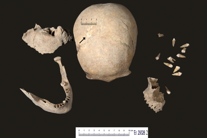 Knochen der Toten von Falein © Archäologischer Dienst Graubünden